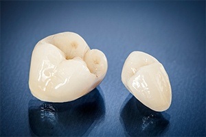 Two dental crown restorations