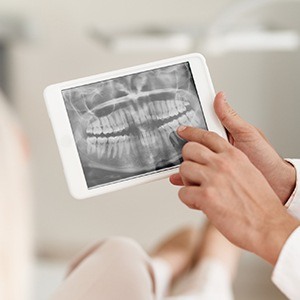 Digital dental x-rays on tablet computer