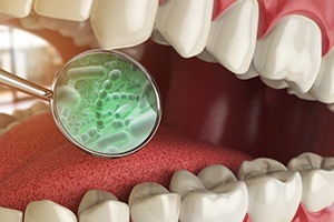 Animation of mouth and oral bacteria