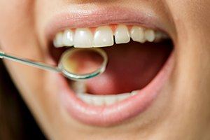 Closeup of smile during dental treatment