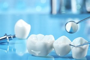 A closeup of a dental bridge against a blue background