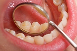 Closeup of health teeth