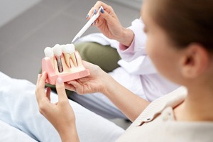 Dental professional using model to explain parts of dental implant