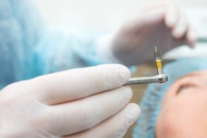 An up-close view of an oral surgeon holding a dental implant and preparing to place it into a patient’s mouth