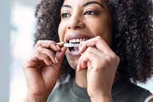 Woman smiling while putting on clear aligner