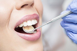 Closeup of smile during dental exam