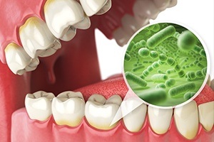 Animation of smile and oral bacteria