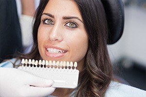 Young woman with teeth compared to color chart