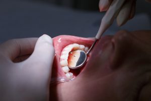 dental checkup 